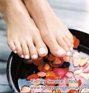 Steroid for Nephrotic Syndrome with Minimal Change on Renal