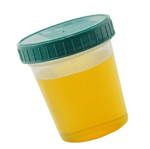 foamy urine treatment