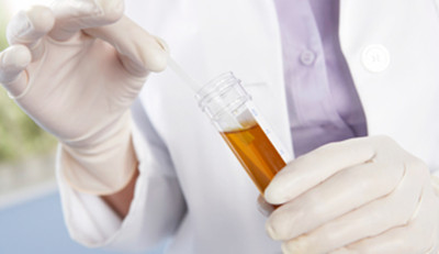 Blood in Urine,kidney stones,peroid blood
