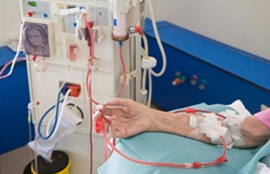 Lupus Nephritis: Can I Avoid Dialysis with Creatinine 300, GFR 18