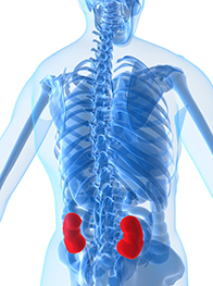 IgA Nephropathy: Should I Get Transplant with Transplanted Kidney Failure