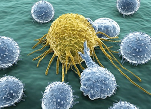 What to Do with Creatinine 7 & Urea 103 after Kidney Transplant