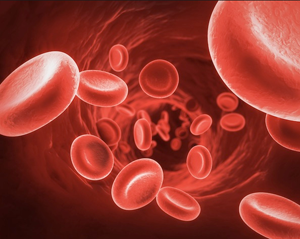 Treatment of Anemia in Diabetes with Stage 4 CKD