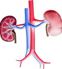 Stage 4 CKD with 28% Kidney Function: Is Transplant a Good Choice