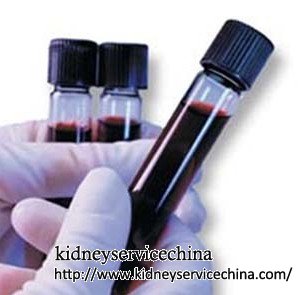 Ideal Treatment for High Blood Pressure and Creatinine Level of 7.2