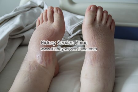 Micro-Chinese Medicine Give Me Second Chance to Live!-Bai Ying from China