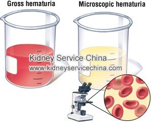 Can End Stage Renal Failure Lead to Hematuria (Blood in Urine)