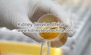 Proteinuria after Renal Transplant: Causes and Treatment