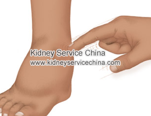 Why Patients With Nephritic Syndrome Have Edema