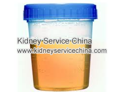Will Foamy Urine Caused By Proteinuria Disappear Quickly