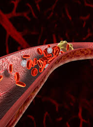 If There Is A Treatment For Stage 4 Kidney Disease Except For Dialysis