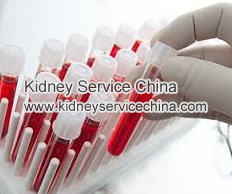 What Is Considered A High Creatinine Level