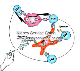 What Treatment Is Good For Lupus Nephritis