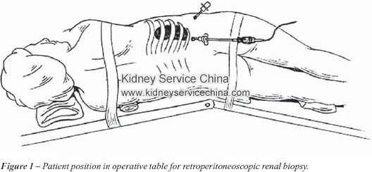Without Getting A Renal Biopsy, Can I tell If I Have IgA Nephropathy
