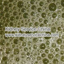 Does Foams In Urine Means You Have Kidney Problem
