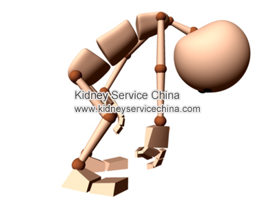 How To Treat Fatigue In Patient With Lupus Nephritis 