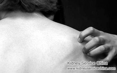 How Can CKD Patient’s Itching Be Treated