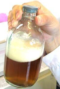 Is Blood In Urine Always A Bad Sign For Patient With Lupus Nephritis