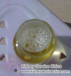 Patient With IgA Nephropathy: why Foams In My Pee