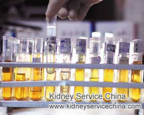 Is Foamy Urine A Bad Indicator For Patients With CKD