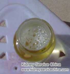 Why Patients With FSGS Often Have Bubbles In Urine