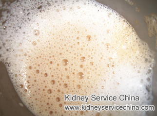 Bubbles In My Urine, Is It The Indication Of Kidney Disease