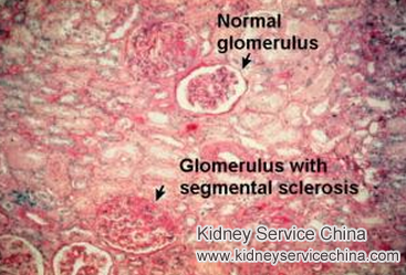 How To treat FSGS Caused By Hypertension