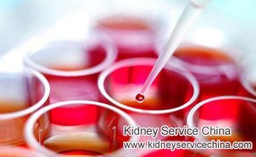 At What Serum Creatinine Level Dialysis Is Required