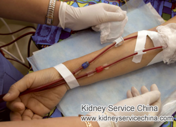 Does Stage 4 Kidney Disease Patients Need to Do Fistula