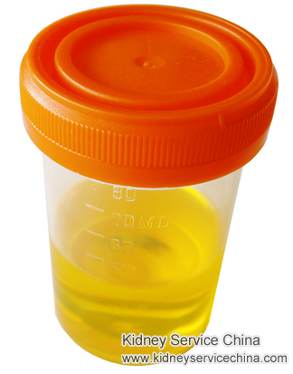 I Have Foamy Urine, Do I Have Kidney Disease