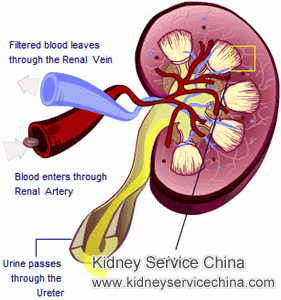 How to Manage Leaking Protein for Nephrotic Syndrome