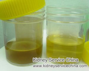 How Often Tea Colored Urine with IgA Nephropathy Occurs