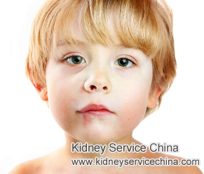 Big Amounts of Protein and Swelling in Face for Nephrotic Syndrome