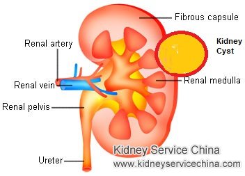 What Are Medical Implications of Multiple Bilateral Renal Cysts