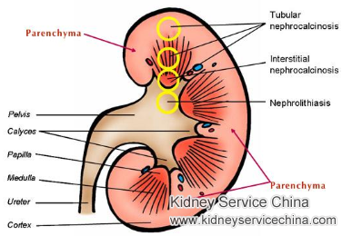 What Is Renal Parenchymal Disease Definition