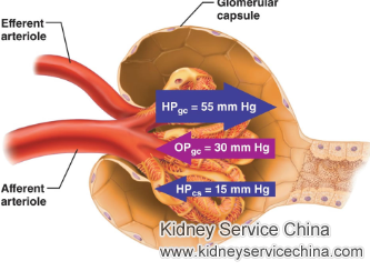 How to Stop Protein Output for FSGS Patients