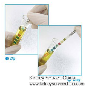 Elevated Microalbumin in Urine for Diabetic Nephropathy Patients