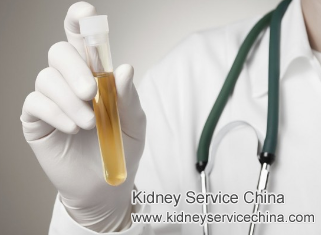 FSGS with Albumin ++++ and Swelling on Face and Legs