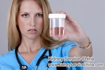 What It Means to See Red Orange Brown Urine with IgA Nephropathy