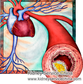 High Blood Pressure Control for Lupus Nephritis Patients