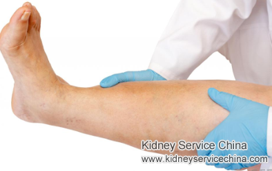 Treatment for Creatinine 2.3 and Swelling in Nephrotic Syndrome