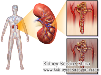 How to Treat Diabetic Nephropathy with Creatinine 6.4