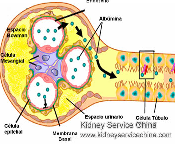 Treatments to Control Protein Loss for Lupus Nephritis