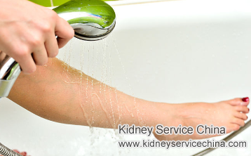 Will FSGS Cause Skin to Be Irritated 