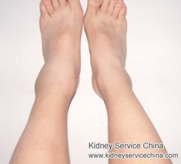 Swelling of Ankles and Hypertensive Nephropathy