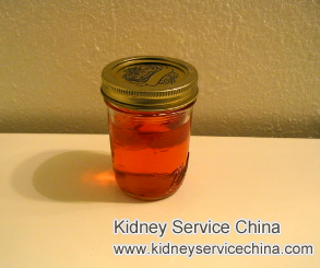 Can Simple Kidney Cyst Cause Blood in Urine