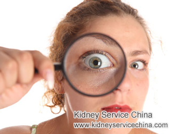 Will IgA Nephropathy Patients Have Eyesight Problem or Not