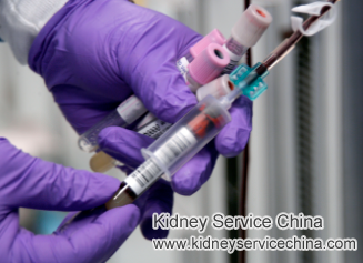 What Should I Do If My Urea Level Is Above 170