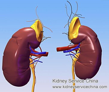 Is Creatinine 1.4 Dangerous for IgA Nephropathy Patients