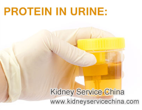 How to Reduce 1206 mg Protein in Urine with IgA Nephropathy